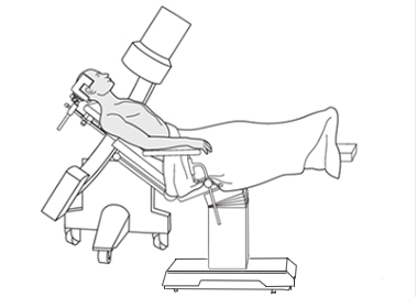 Beach Chair Surgical Position: Benefits, Risks, and Best Practices
