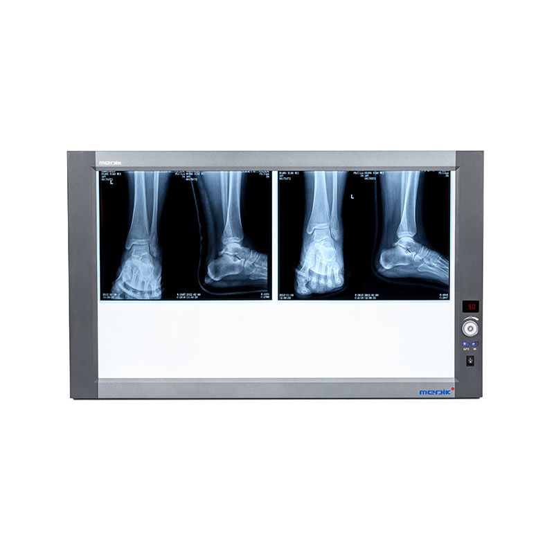 YA-NS02 Double-panel Led X-ray film viewer