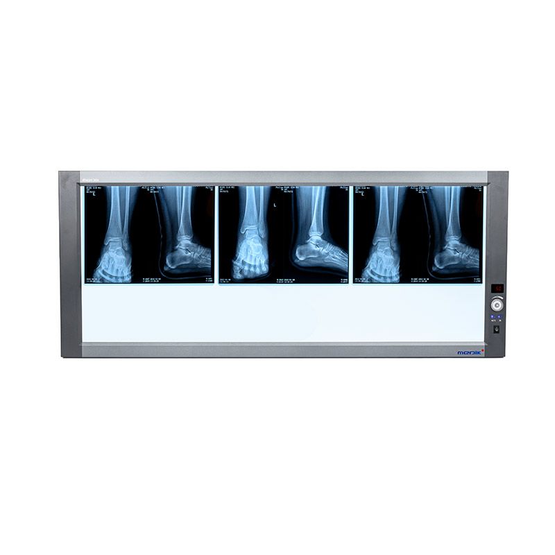 YA-NS03  Digital LED Screen X Ray Viewer Negatoscope