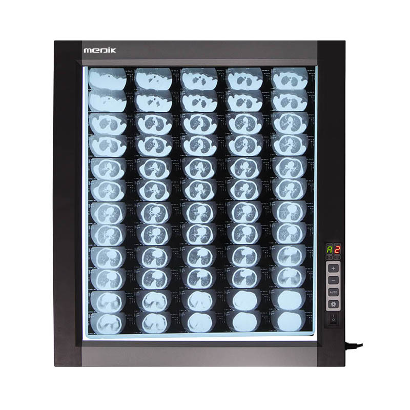YA-NS01D Led X Ray Film Viewer