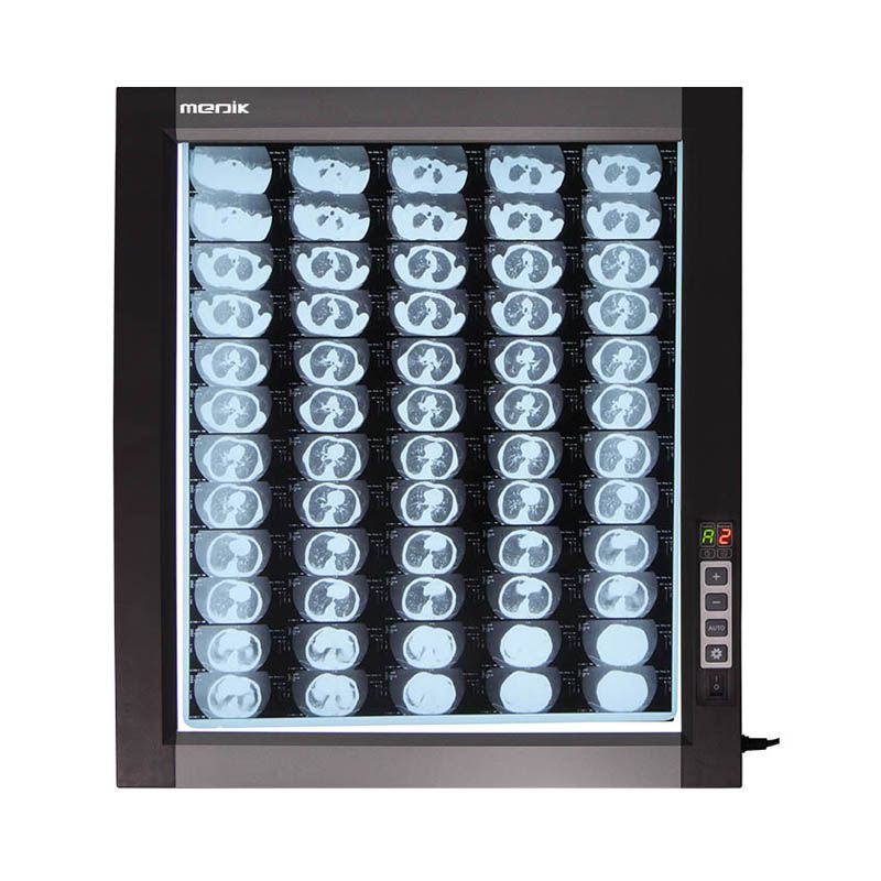 YA-NS01D Led X Ray Film Viewer
