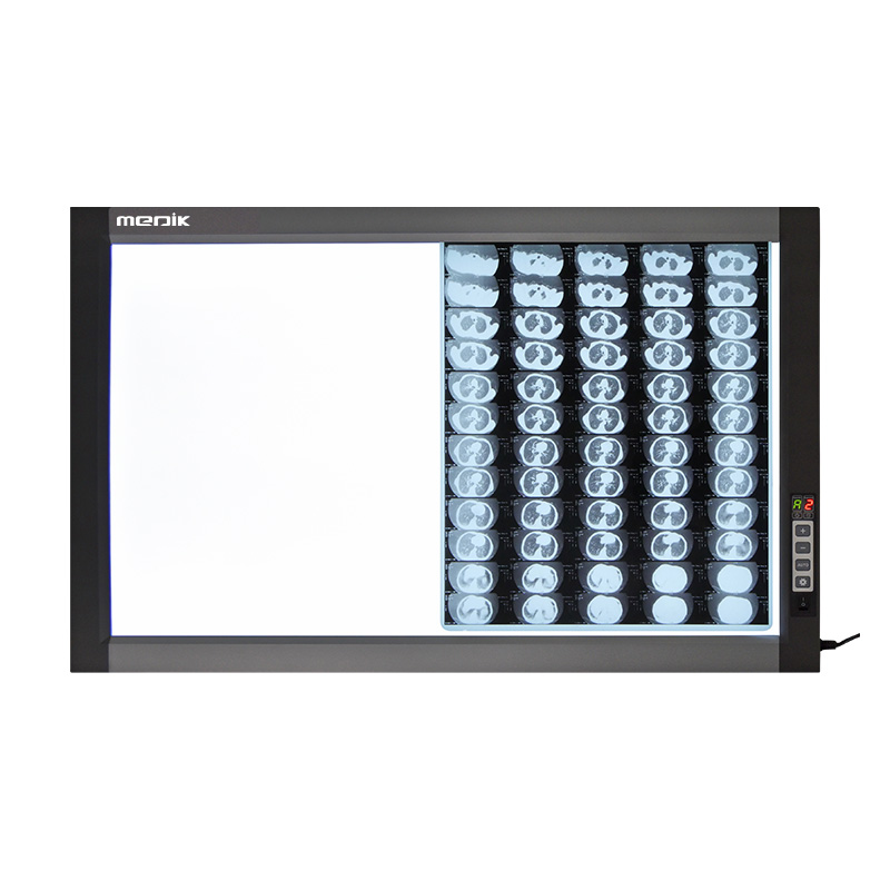YA-NS02D 2-SCREEN LED X-ray Film Viewer