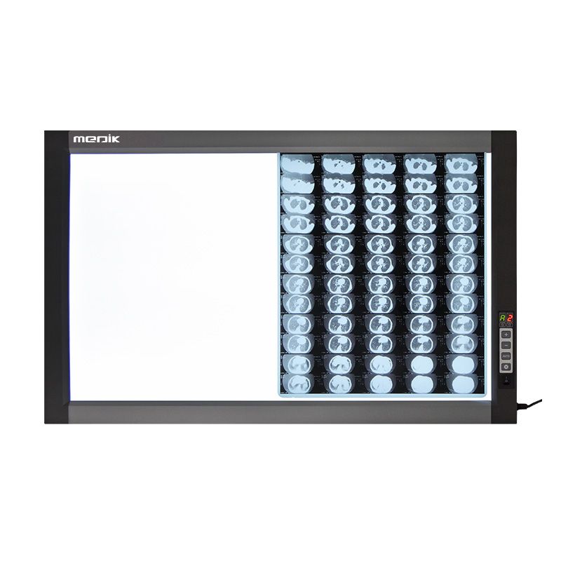 YA-NS02D 2-SCREEN LED X-ray Film Viewer