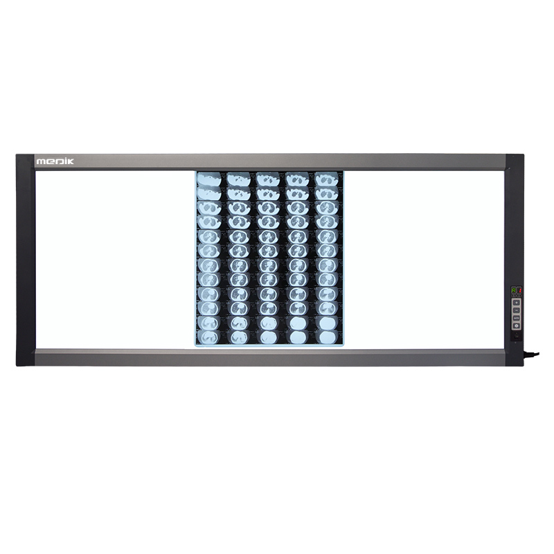 YA-NS03D 3-SCREEN Side-Lit LED X-ray Film Viewer