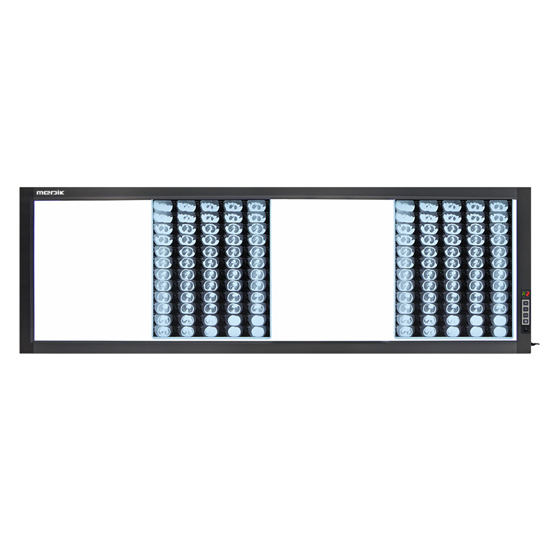 YA-NS04D Digital 4-SCREEN LED X-ray Film Viewer