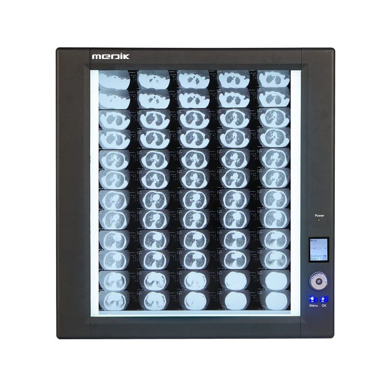 YA-NS01G Single Panel Negatoscope for clinical X-ray