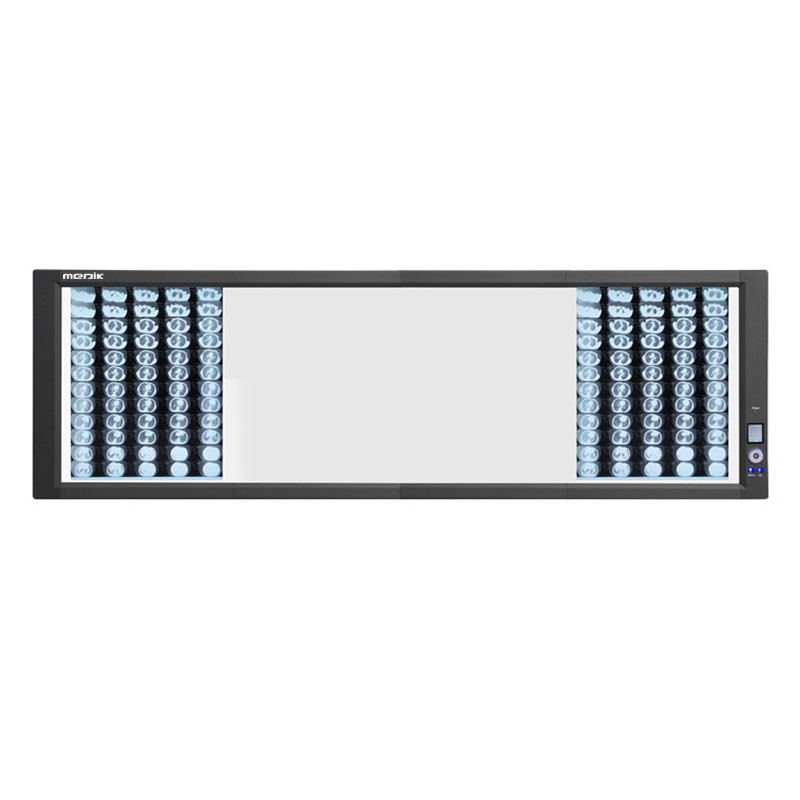 YA-NS04G Back-Lit 4 Panel Medical LED Negatoscope