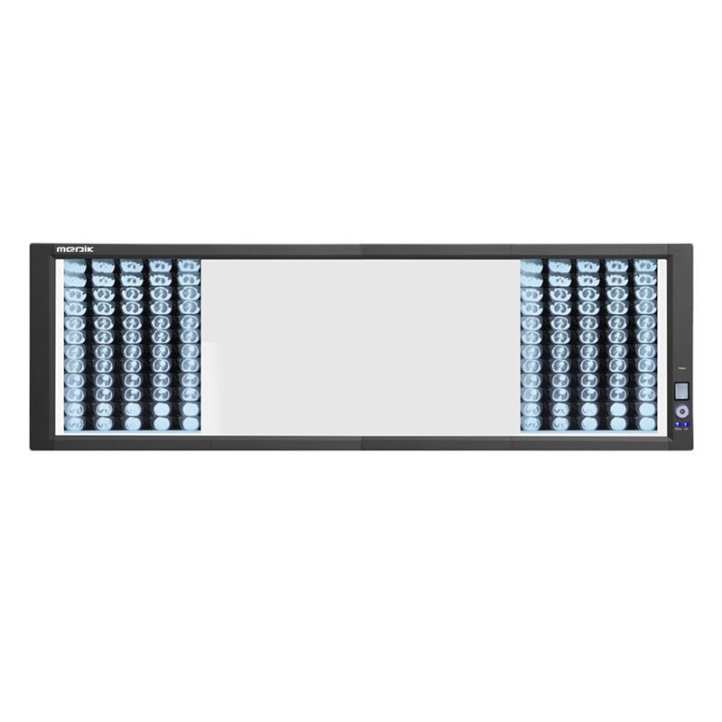 YA-NS04G Back-Lit 4 Panel Medical LED Negatoscope