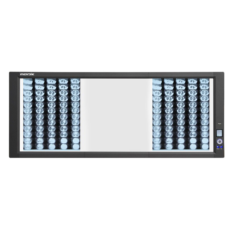YA-NS03G Back-Lit LED 3 Panel Medical Negatoscope