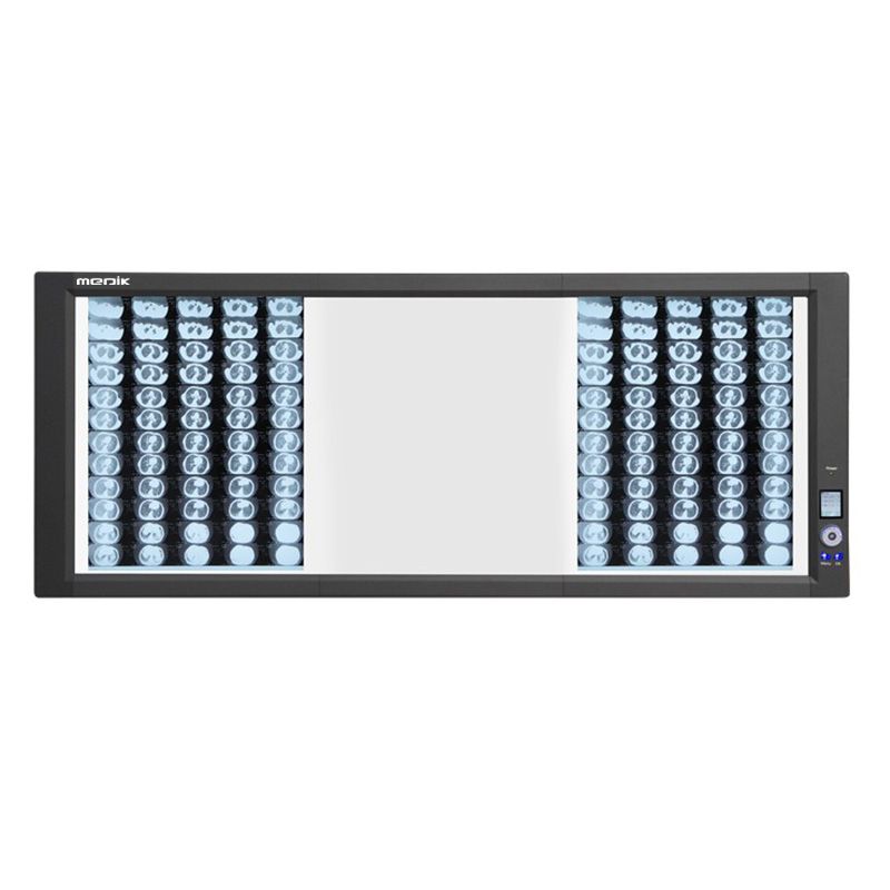 YA-NS03G Back-Lit LED 3 Panel Medical Negatoscope