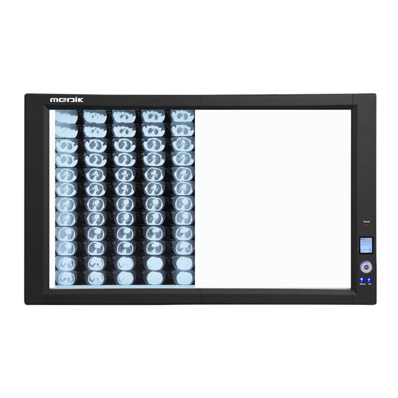 YA-NS02G Double Panel Medical LED Negatoscope
